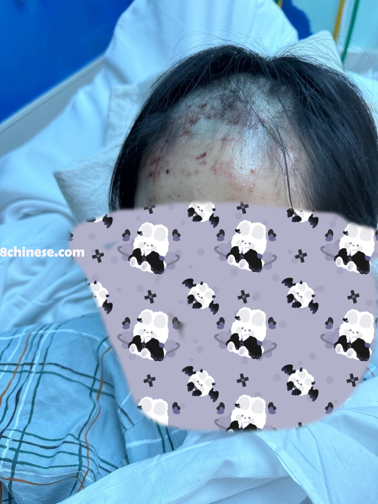 16岁华裔受害少女Mary(化名)虽已出院返家，身体伤势逐渐稳定，然而情绪与行为依然反映出创伤未愈。(受害者家属提供)